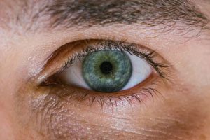 blépharoplastie tunisie